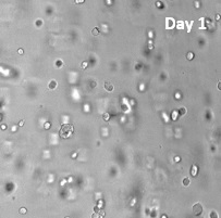 膠芽腫細胞（U-87 MG）の3D培養